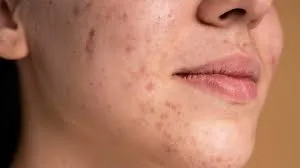 Illustrative image for Skin Care